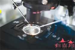 杭州代怀流程，杭州主城区40岁以上常住人口可免费测血脂