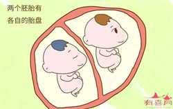 杭州借卵子成功率多少，美国试管婴儿取卵流程是怎样的？