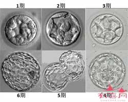 杭州借卵试管可以吗，卵巢早衰后还能吗？