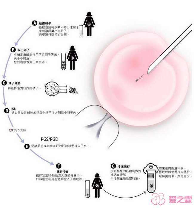 浙江爱心捐卵中心,杭州有做供卵试管的医院吗？附详细医院排名