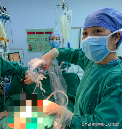 女孩输卵管内查出皮球大囊肿，专家2厘米小切口成功剥除