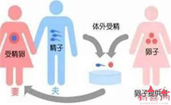 浙江30万代生,杭州供卵试管婴儿代生医院排名
