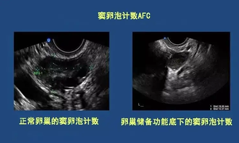 杭州借卵生子条件,三代试管借卵生子会与无血缘关系的生母长得越来越像吗？