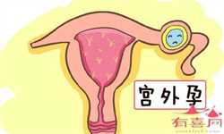 杭州卵巢早衰供卵成功,湖南供卵试管婴儿机构排行榜，附3家三代试管医院名单