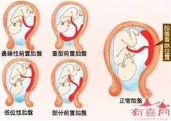 杭州供卵的机构在哪,广州供卵第三代试管婴儿医院排名，附试管代怀生子机构